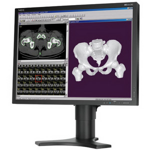 Изображения NEC MDview 202